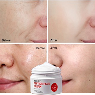 Mmjd Peptide ครีมบํารุงผิวหน้า ต่อต้านริ้วรอย ขนาด 30 กรัม