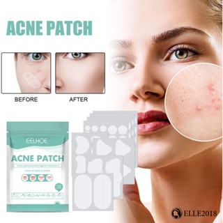 EELHOE Mask Patch Fade Imprint Repair Nourish for a Healthy Clear Complexion Refreshing Highly rated Skin rejuvenation Solution Clarifying Pimple patch อ่อนโยน 【elle20181_th】