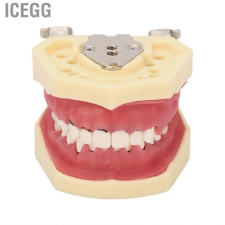 Icegg Periodontal Disease  Model  Exhibition Teaching Resin Educational Demonstration  for Root Planing