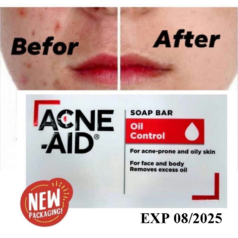 Acne-Aid bar soap 100g. สบู่ก้อน Acne-Aid เหมาะสำหรับผิวแพ้ง่าย เป็นสิวง่าย