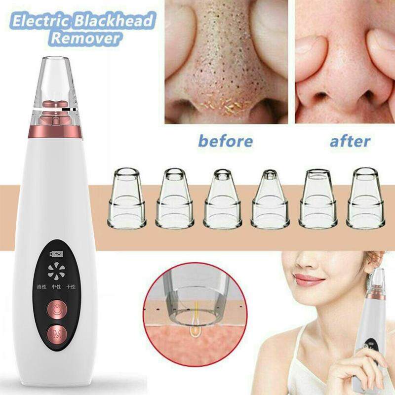 เครื่องดูดสิวเสี้ยน ปรับแรงดูดได้ 3 ระดับ พร้อมจอ LED