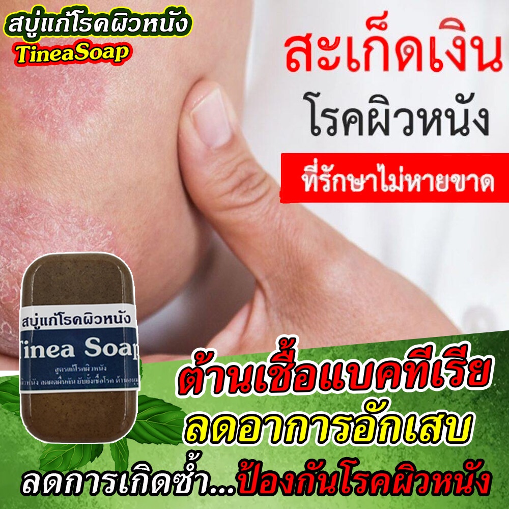 สบู่สมุนไพร 11 ชนิด แก้อาการคันในร่มผ้า ผดผื่นคัน กลาก เกลื้อน สบู่พญายอ สบู่พลูคาว