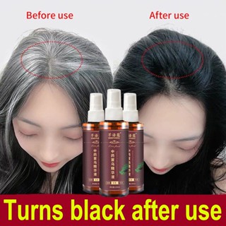 Sma Black Hair Essence สเปรย์ย้อมผม แชมพูปลูกผม สีดํา 100 มล. โพลีโกนัม มัลติฟลอรัม ธรรมชาติ กําจัดขนขาว ผมดํา ส่งเสริมการเจริญเติบโตของเส้นผม