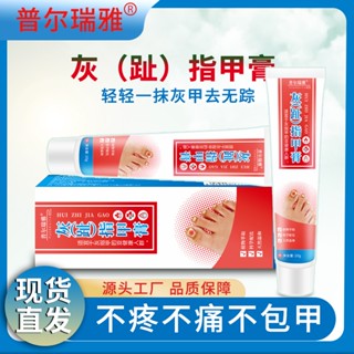 Spot# factory spot toe finger gray nail cream hand thickened nail embedded nail gray nail ointment hormone-free one-piece delivery 8jj