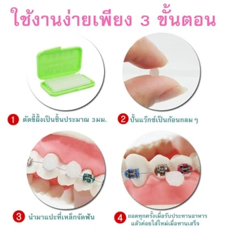 ส่งเร็วทันใจขี้ผึ้งสำหรับคนจัดฟัน ช่วยป้องกันการระคายเคือง การเกิดแผลจากการบาดในช่องปาก มีหลายกลิ่น ขี้ผึ้งจัดฟัน ดีดี
