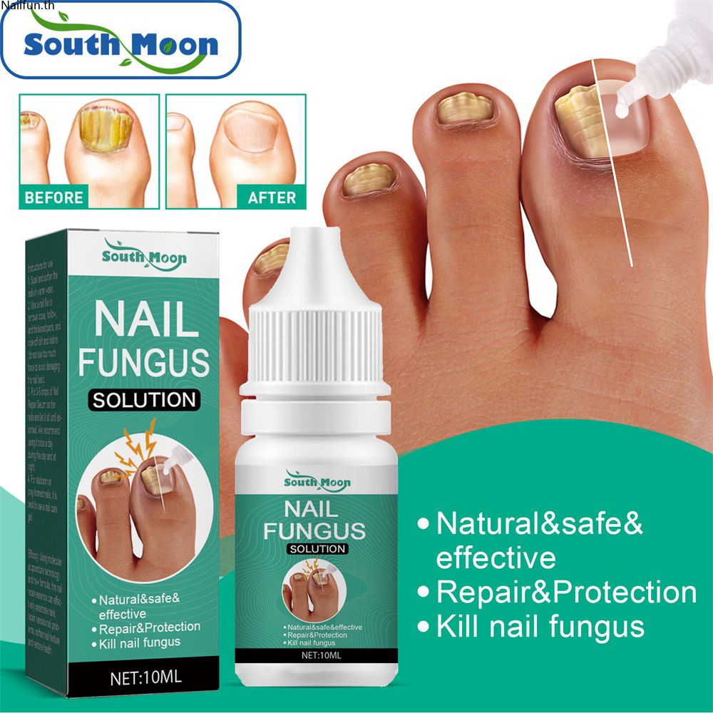 ✅COD South Moon NAIL Fungus Solution เซรั่มซ่อมแซมเล็บ Essence คุด Toenail Fungal Treatment Essence Anti Infection ลบเล็บหนังกำพร้า Feet Care 10ml