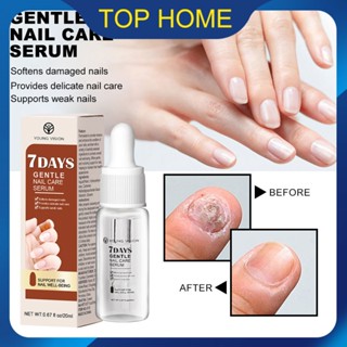 YOUNG VISION 7Day Nail Repair Essence Solution สำหรับ Onychomycosis เล็บที่อ่อนแอและการดูแลเล็บส่งเสริมการเจริญเติบโตของเล็บเล็บที่แข็งแรง หนาแน่นโซลูชันการดูแลเล็บขั้นสูง ว้าว ~ ราคาต่ำสุด