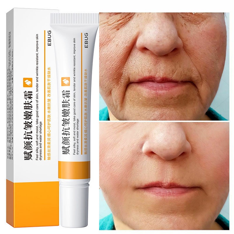 Anti-aging Retinol Facial Cream/Aging/Firm/Removes Hair Line/Bleaching/Moisturization