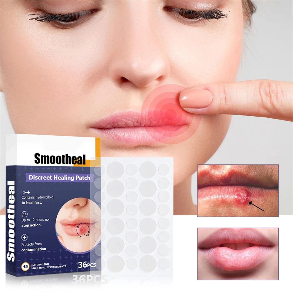 ซ่อมแซมริมฝีปาก Lip Care Herpes Paste Care Patch ต้านเชื้อแบคทีเรียและต้านการอักเสบเย็น Herpes Smoothing Patch สติกเกอร์พยาบาล