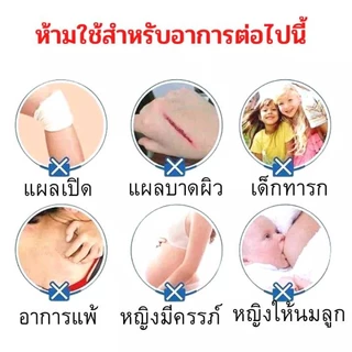 แผ่นแปะสมุนไพรจีนลดปวดเมื่อยอินฟราเรด 1กล่อง8แผ่น สูตรโกฐจุฬาลัมพาจีนออกฤทธิ์ร้อนอ่อนๆ แปะผ่อนคลาย