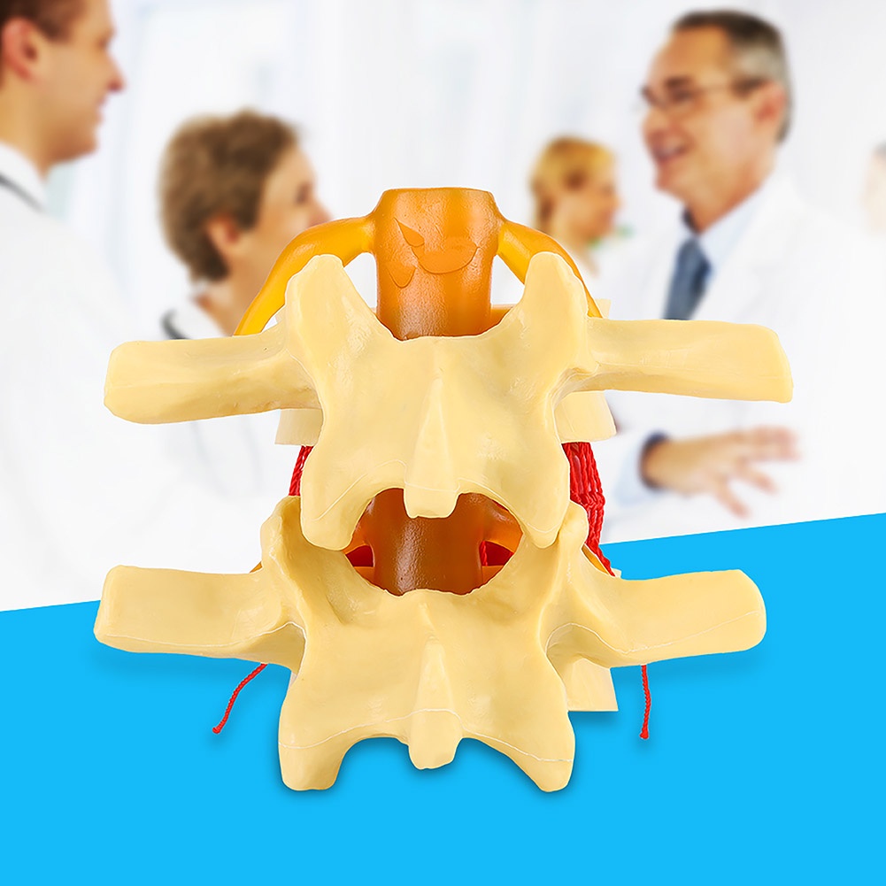 Ryo *❤❤Human Anatomical Lumbar Disc Herniation Model