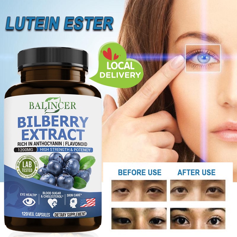 Bilberry extract supplement to reduce intraocular pressure and improve high eye, anti-aging, beauty and brain health