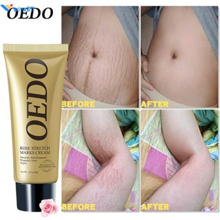 OEDO Rose Stretch Mark Cream ขจัดเครื่องหมายยืด ผิวเต่งตึง การดูดซึมอย่างรวดเร็ว ให้ความชุ่มชื้น ครีมบำรุงความงาม Rose Infused Selfconfidence Stretch Marks Removal wine011