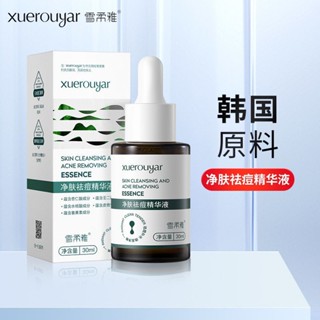 Spot snow soft elegant skin cleansing acne removing essence fine pores fade acne marks acne marks salicylonolic acid acne removing essence 0901hw