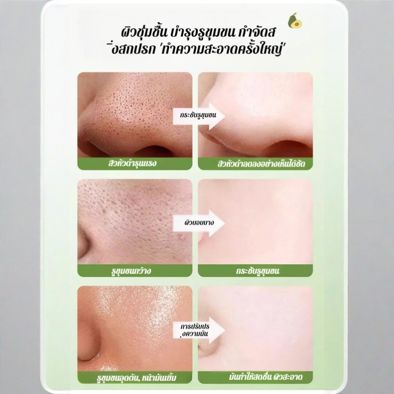 24Hพร้อมส่งในไทย🚚มาส์กฟองอะโวคาโด มาส์กล้างหน้า เน้นแก้ปัญหารูขุมขนกว้าง สิวหัวดำ ทำความสะอาดรูขุมขน/บับเบิ้ลมาส์กให้ความสดชื่นและควบคุมความมัน มาส์กโฟมคอมโพสิต สูตรใบบัวบก  ให้ความชุ่มชื้น  เหมาะกับทุกสภาพผิ - รูปที่ 7