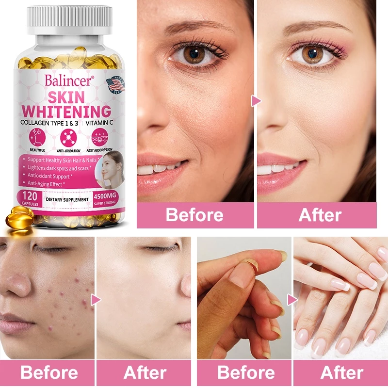 Balincer Glutathione อาหารเสริมผิวขาว thumbnail 4