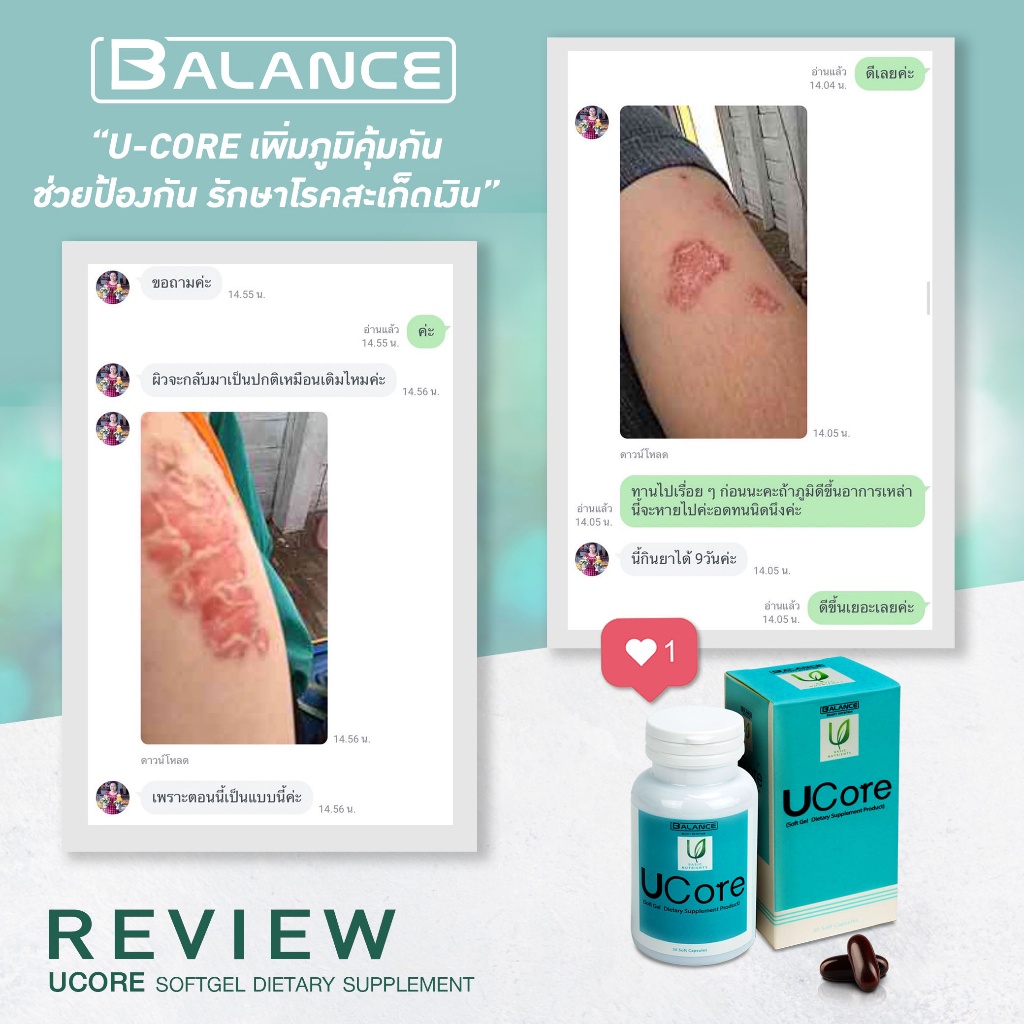 Balance UCore ของแท้ 100% ส่งตรงจากบริษัทเองโดยตรง balance u core ของแท้ balance u core อาหารเสริมแก