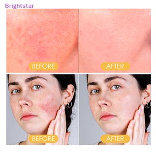 Brightstar แผ่นสติกเกอร์ ป้องกันรังสียูวี 24 ชิ้น