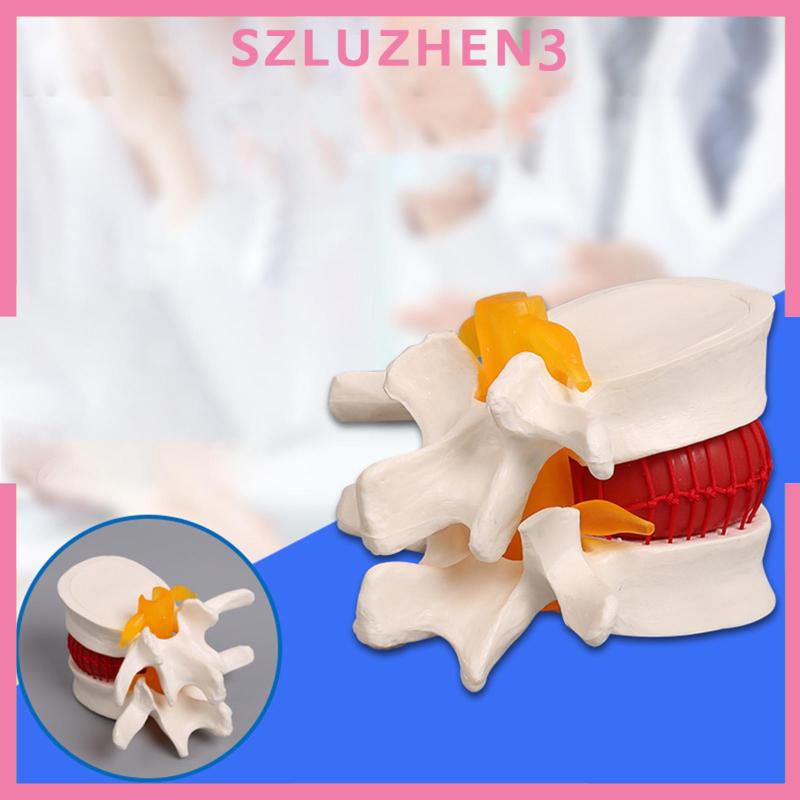 [Szluzhen3] โมเดลกระดูกสันหลัง 1:1 สําหรับสาธิต