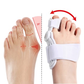 1 ชิ้น Hallux Valgus แก้ไขตาปลา สําหรับนิ้วเท้า แยกนิ้วเท้า แยกนิ้วเท้า ดูแลเท้า แก้ไขตาปลา ฮาลักกี้