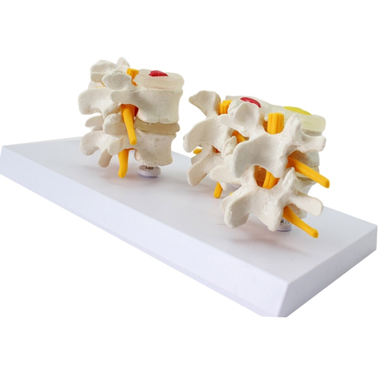 Stat Anatomical Human Lumbar Spine Model Four Stage Lumbar Spine Anatomy Model for Demonstruction Di