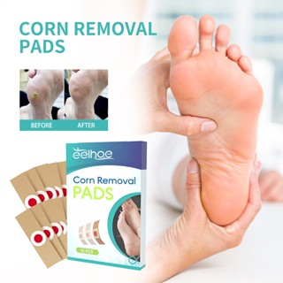 Daily premium# EELHOE corns repair stickers feet corns calluses dead skin moisturizing skin cleaning cutin corns care stickers 9.11Li