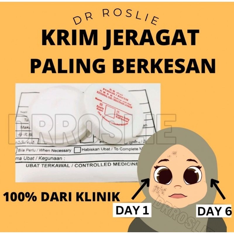 [ Krim Jeragat 100% Berksan ] (จัดส่งใน 24Hr ) Dr Roslie Anti-Freck Treatment Cream