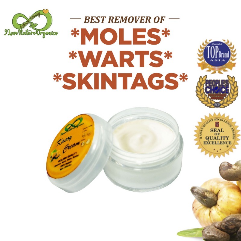 Kasoy Cream Mole Remover Warts Skin Tag