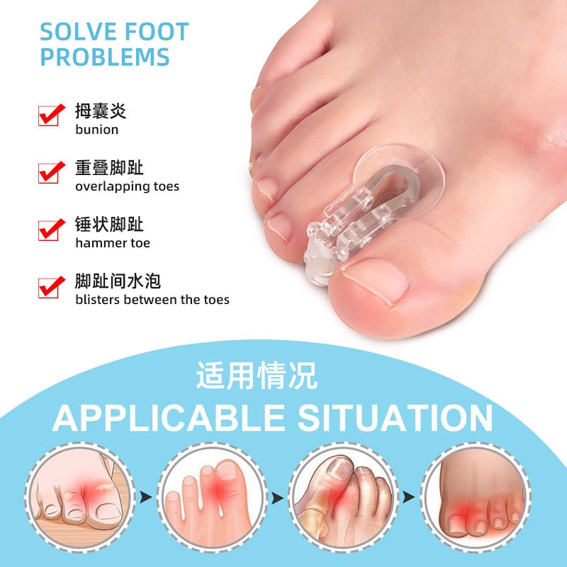 พร้อมส่ง แยกนิ้วเท้า 1 คู่ นิ้วหัวแม่มือ valgus Corrector ตัวคั่นนิ้ว SC56