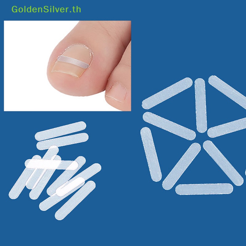 Goldensilver แผ่นสติกเกอร์ ยืดหยุ่น สําหรับรักษาเล็บคุด 10 ชิ้น