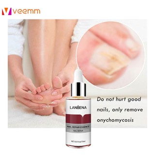 Lanbena Nail Repair Essence Serum Fungal Nail Treatment 12ml. เซรั่มบำรุงเล็บ Lanbena Nail Repair Essence Serum Fungal Nail Treatment 12ml