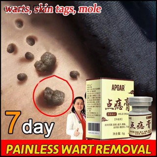 APGAR เข้มข้นที่มีศักยภาพแท็กผิวครีมกำจัด Body Warts ครีม Spot Mole Ointment-eelhoe