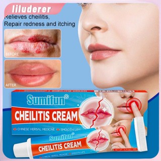 Sumifun Cheilitis Treatment Lip Care Lip Treatment/บาล์มบำบัด Dead Skin Remover ริมฝีปากแตก HO