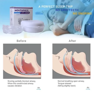 Comfort-Fit Night Guard สําหรับ Snoring & Bruxism - ส่งเสริมการนอนหลับอย่างสงบพร้อมบรรเทาที่ปรับแต่งได้สําหรับการหยุดหายใจการนอนหลับที่นุ่มนวลและระบายอากาศได้ดี