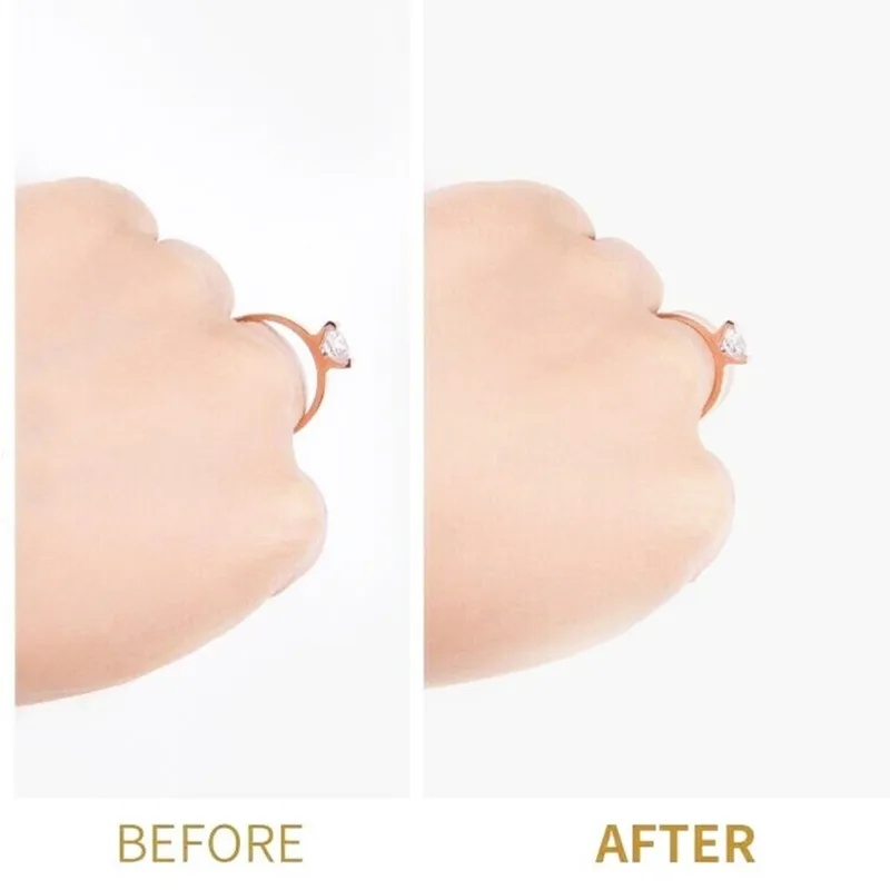 แผ่นยางรองแหวน ปรับขนาดได้ สําหรับแหวนหลวม แหวนด้านใน - รูปที่ 4