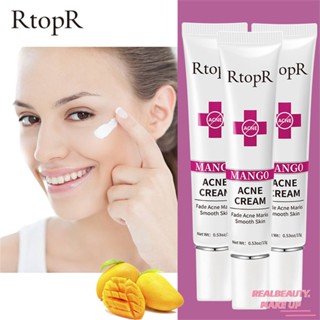 RtopR Mango Anti Cream ครีมไวท์เทนนิ่งควบคุมความมันรูขุมขนหดตัว Moisturizing Acne Removal Skin Care Enhanced Repair Facial Care ขจัดความเสียหายผิวครีมสิว [realbeauty]