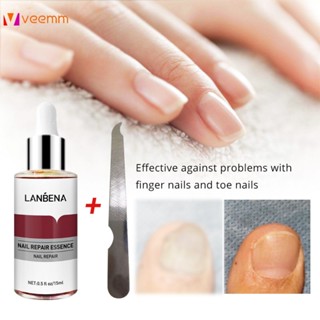 นาฬิกา Lanbena Nail Repair Essence เซรั่ม Fungal Treatment ลบ Onychomycosis Toe บำรุงผิวกระจ่างใสมือเท้า Skin Care 15ml veemm