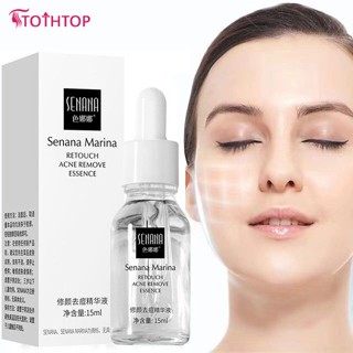 Senanaไวท์เทนนิ่งกระจุดด่างดำEssence Water-Moisturizing Anti-Acne Anti-Wrinkle Fine Pore Essence Original Solution Skin Care [TOP]