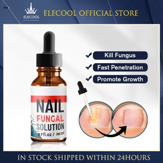 Eeihoe 30ml ขิงเล็บ Fungal Treatment Foot Care Essence เท้า Liquid การติดเชื้อ Anti กำจัด Toe Repair Removal Liquid nuuo