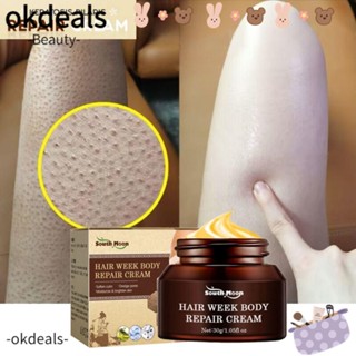 Okdeals Keratosis Pilaris ครีมบํารุงผิว กําจัดสิว ให้ความชุ่มชื้น 30 กรัม สําหรับผู้หญิง