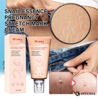 Wiieey Snail Essence Stretch Mark Cream - 60ml 【elle20181_th】