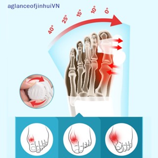[aglanceofjinhui] อุปกรณ์เฝือกปรับนิ้วเท้า ปรับขนาดได้ [ZKM]