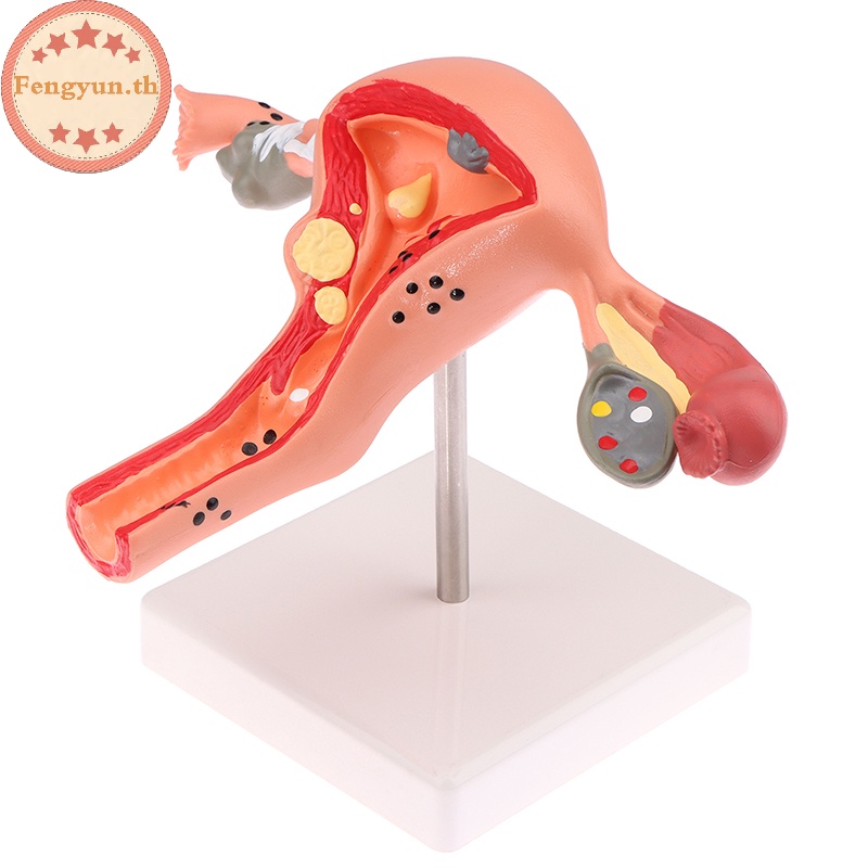 Fengyun มดลูกรุ่น Props Anatomy 1 ชิ้น
