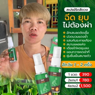 (การันตีของแท้💯) SN9สเปรย์ฉีดริดสีดวง ฉีดติ่งยุบ สมาน แผล ไม่อักเสบ หดเข้าที่ SN9สเปรย์ฉีดริดสีดวง สมุนไพร (ท้องใช้ได้)