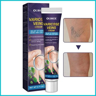 Varicose Vein Cream Natural Varicose &amp; Spider Veins ครีมบํารุงขา ช่วยบรรเทาอาการปวดเมื่อย 20 กรัม
