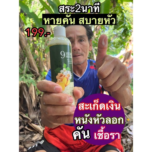 ส่งฟรี โปรเด็ด 2 แถม 1 แชมพู ขุนเดช แชมพูบำรุงผม ช่วยฟื้นฟูผมร่วง รังแค หนังศีรษะมัน ผมหงอก แก้คันหนังศรีษะ แก้เชื้อรา
