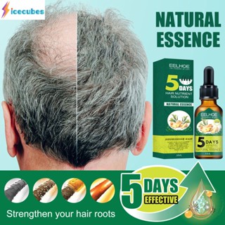 New Hair Essence 30ml Anti-hair Loss Solution ซ่อมแซมผมเสียได้เร็วขึ้นและเป็นธรรมชาติ ICECUBES