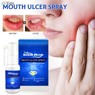 SOUTHMOON Oral Repair Spray บรรเทาอาการบวมปวด Aid Gum สุขภาพปริทันต์ธรรมชาติปลอดภัย Oral Care (จัดส่งวันนี้)