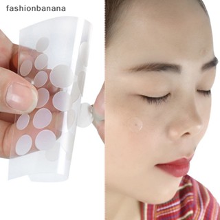 [fashionbanana] แผ่นแปะสิว กําจัดสิวเสี้ยน อย่างมีประสิทธิภาพ สินค้าใหม่