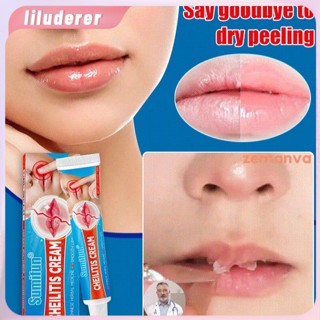 Sumifun Cheilitis Balm Lip Care Skin ภายนอกครีม HO